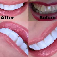 دندانپزشکی  زیبایی و درمانی|خدمات آرایشگری و زیبایی|تهران, قیطریه|دیوار