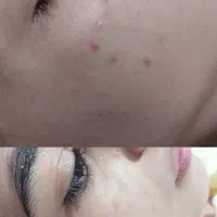 خدمات زیبایی پوست و ماساژ برای خاص پسندان