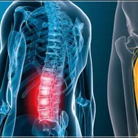 فیزیوتراپی در مطب ما و یا در منزل شما