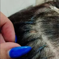 مدل اکستشن مو