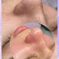 کلینیک زیبایی هوربانو جردن|خدمات آرایشگری و زیبایی|تهران, جردن|دیوار