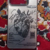 گارد گوشی نوت 13 پرو 5g