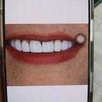 منشی در دندانپزشکی و دندانسازی