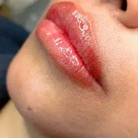 میکرو بلدینگ فیبروز شیدینگ