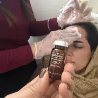 مدل برای فیلر لب