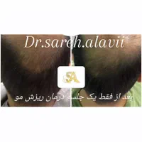 درمان ریزش مو توسط پزشک|خدمات آرایشگری و زیبایی|قم, دورشهر|دیوار