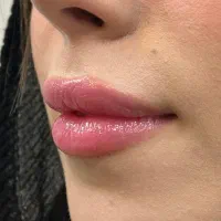 کلینیک زیبایی پارس‌آباد - بوتاکس، ژل، جوانسازی