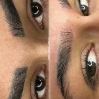ریموو تخصصی و اصولی انواع تاتو (ابرو، چشم، لب)