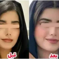 چاقی بدن و صورت