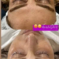 پاکسازی فیشال و آبرسانی درمان لک و جوش|خدمات آرایشگری و زیبایی|زابل, |دیوار