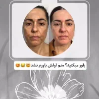 کرم ضدلک گیاهی ژل رویال|آرایشی، بهداشتی، درمانی|اسدآباد, |دیوار