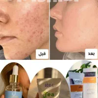 تنها نمایندگی سرم مغذی (همه کاره) لاکچری کوین|حراج|مشهد, فردوسی|دیوار