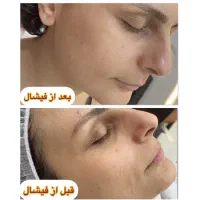 فیشال تخصصی و پاک سازی