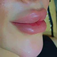 اموزش چال گونه وپیرسینگ