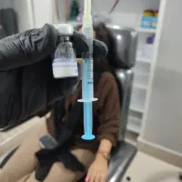 پی آر پی و پی آر اف بوتاکس و مزوتراپی وهیرفیلر