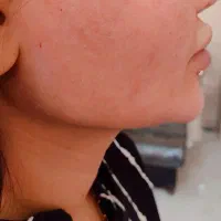 ژل و بوتاکس|خدمات آرایشگری و زیبایی|مسجد سلیمان, |دیوار