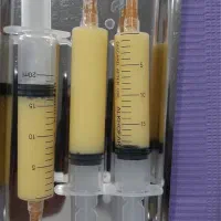 جوانساز پی آر پیprp صورت و ریزش مو و زخم و لک|خدمات آرایشگری و زیبایی|هشتگرد, شهرک ولیعصر (مصلی)|دیوار