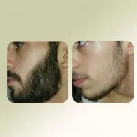 ۲۵روزه|آرایشی، بهداشتی، درمانی|مشهد, انصار|دیوار