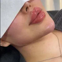 جشنواره ۳۰٪ تابستانه فیلر/بوتاکس/پی ار پی|خدمات آرایشگری و زیبایی|اهواز, کیان اباد|دیوار