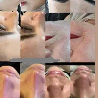 فیشال داخل کیلینیک وسالن زیبایی|خدمات آرایشگری و زیبایی|قم, صدوق|دیوار