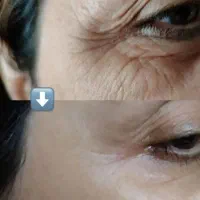 محصولات مراقبت پوستی|آرایشی، بهداشتی، درمانی|کامفیروز, |دیوار