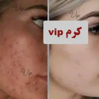 کرمvip