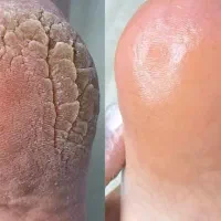 پدیکورپا|خدمات آرایشگری و زیبایی|قم, نیروگاه|دیوار