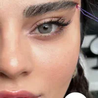 تزریق ژل و بوتاکس بهاره