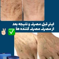 کرم ضدلک لاکچری کوین اصل|آرایشی، بهداشتی، درمانی|شیراز, فرهنگ شهر|دیوار