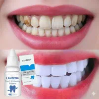 سرم سفیدکننده دندان مدل DentoraX/سفیدی فوری