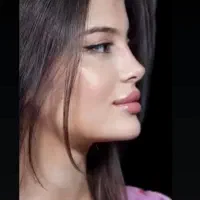 تخفیف جراحی بینی قیمت ۳۶-۴۰ میلیون