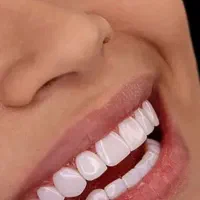 همه خدمات دندانپزشکی...جشنواره تخفیفی تا‌‌۴۰درصد