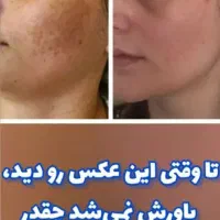 زیبایی صورت|آرایشی، بهداشتی، درمانی|خاش, |دیوار