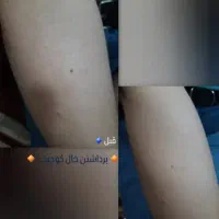 مدل رایگان جهت خدمات زیبایی پلکسرنیازمندیم