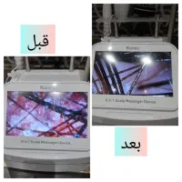 مدل پاکسازی کف سر