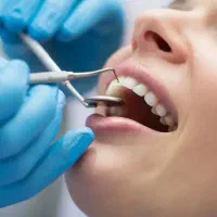 جشنواره تخفیف ویژه دندانپزشکی،موادعالی،بیمه تکمیلی