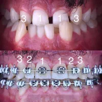 ارتودنسی فقط ۱۳ میلیون اقساط بدون چک.|خدمات زیبایی و سلامت|تهران, جردن|دیوار