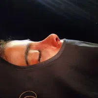 عمل جراحی بینی فقط برای ۵نفردیگه 17/500ظرفیت محدود