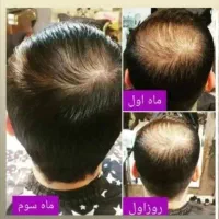 دعوت به مشاوره رایگان|آرایشی، بهداشتی، درمانی|شیراز, ابیوردی|دیوار