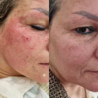 خال برداری، صافی مو کراتین وپروتین و آموزش