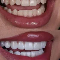 دندانپزشکی