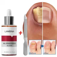 سرم تقویت کننده ناخن مدل LANBENA.پرداخت درب منزل