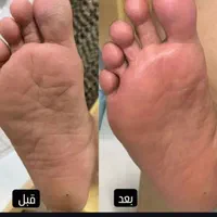پدیکورتخصصی.وکف سابی و پارافین تراپی