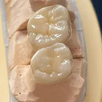 آموزش حرفه ای کار درمانی و زیبایی دندانپزشکی