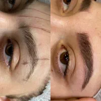 فیبروز ابرو