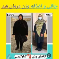 چاقی و اضافه وزن