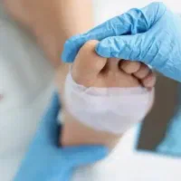 درمان زخم دیابتی/بستر/جراحی/زگیل تناسلی/سرم تراپی