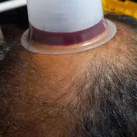 حجامت/رگگیری سیاتیک/زالودرمانی|خدمات آرایشگری و زیبایی|شیراز, عادل آباد|دیوار