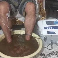 سمزدایی وحجامت|خدمات آرایشگری و زیبایی|کرج, گلشهر|دیوار