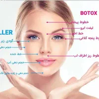 مدل تزریق فیلر(ژل) و بوتاکس